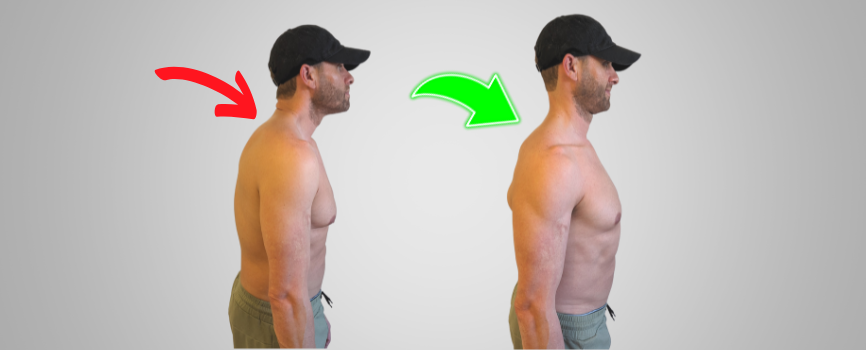 A Complete Guide to Fixing Forward Head Posture – Posture Guy Mike